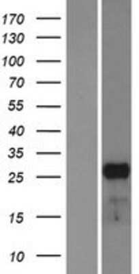 Western Blot: Mesp1 Overexpression Lysate (Adult Normal) [NBP2-06783] Left-Empty vector transfected control cell lysate (HEK293 cell lysate); Right -Over-expression Lysate for Mesp1.