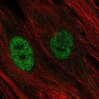 Immunocytochemistry/Immunofluorescence: Metallothionein-1E Antibody [NBP1-87740] - Staining of human cell line BJ shows localization to nucleoplasm. Antibody staining is shown in green.