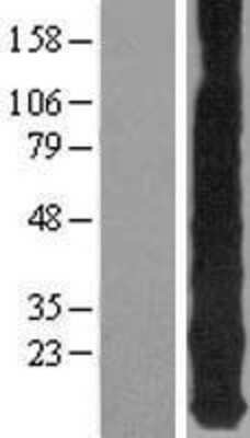 Western Blot: Metallothionein-1E Overexpression Lysate (Adult Normal) [NBP2-05063] Left-Empty vector transfected control cell lysate (HEK293 cell lysate); Right -Over-expression Lysate for Metallothionein-1E.