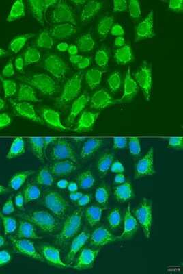 Immunocytochemistry/Immunofluorescence: Metaxin 1 Antibody [NBP3-03536] - Analysis of U2OS cells using Metaxin 1 antibody at dilution of 1:100. Blue: DAPI for nuclear staining.