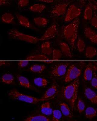 Immunocytochemistry/Immunofluorescence: Metaxin 1 Antibody [NBP3-03536] - Analysis of U2OS cells using Metaxin 1 antibody at dilution of 1:100. Blue: DAPI for nuclear staining.