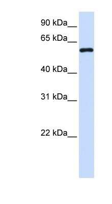 Western Blot: Metaxin 1 Antibody [NBP1-59449] - Human Brain lysate, concentration 0.2-1 ug/ml.