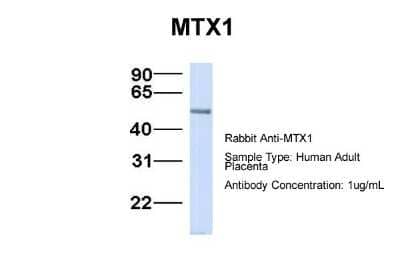 Western Blot: Metaxin 1 Antibody [NBP1-59449] - Human Adult Placenta, Antibody Dilution: 1.0 ug/ml.