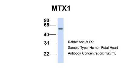 Western Blot: Metaxin 1 Antibody [NBP1-59449] - Human Fetal Heart, Antibody Dilution: 1.0 ug/ml.