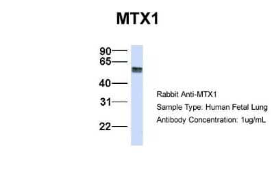 Western Blot: Metaxin 1 Antibody [NBP1-59449] - Human Fetal Lung, Antibody Dilution: 1.0 ug/ml.