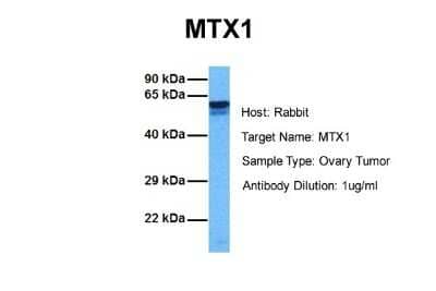 Western Blot: Metaxin 1 Antibody [NBP1-59449] - Sample Tissue: Human Ovary Tumor Antibody Dilution: 1.0 ug/ml