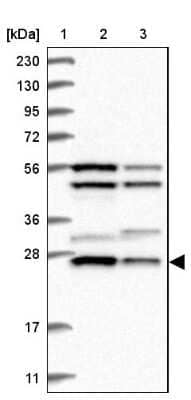 Western Blot: Metaxin-2 Antibody [NBP1-87435] - Lane 1: Marker  [kDa] 230, 130, 95, 72, 56, 36, 28, 17, 11.  Lane 2: Human cell line RT-4.  Lane 3: Human cell line U-251MG sp