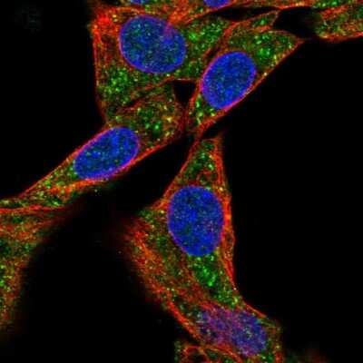 Immunocytochemistry/Immunofluorescence: Methionine Aminopeptidase 1D/MAP1D Antibody [NBP2-48593] - Immunofluorescent staining of human cell line Hep G2 shows localization to vesicles. Antibody staining is shown in green.