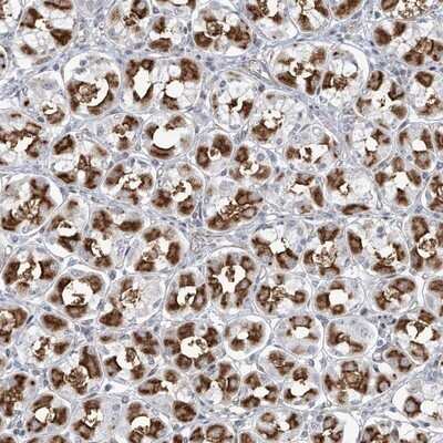 Immunohistochemistry-Paraffin: Methionine Aminopeptidase 1D/MAP1D Antibody [NBP1-92098] - Staining of human stomach shows strong cytoplasmic positivity in parietal cells.