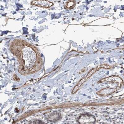 Immunohistochemistry-Paraffin: Methionine Aminopeptidase 1D/MAP1D Antibody [NBP1-92098] - Staining of human stomach shows strong cytoplasmic positivity in parietal cells.