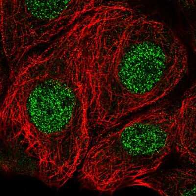 Immunocytochemistry/Immunofluorescence: Methionine Sulfoxide Reductase A Antibody [NBP2-55671] - Staining of human cell line MCF7 shows localization to nucleoplasm.