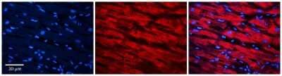 Immunohistochemistry: Methionine Sulfoxide Reductase A Antibody [NBP1-57727] - Formalin Fixed Paraffin Embedded Tissue: Human heart Tissue Observed Staining: Cytoplasmic Primary Antibody Concentration: N/A Other Working Concentrations: 1:600 Secondary Antibody: Donkey anti-Rabbit-Cy3 Secondary Antibody Concentration: 1:200 Magnification: 20X Exposure Time: 0.5 - 2.0 sec