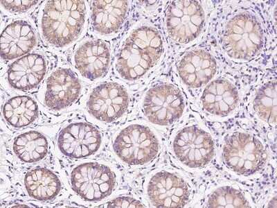 Immunohistochemistry-Paraffin: Methionine Sulfoxide Reductase A Antibody [NBP2-97475] - Immunochemical staining of human Methionine Sulfoxide Reductase A in human colon with rabbit polyclonal antibody at 1:200 dilution, formalin-fixed paraffin embedded sections.