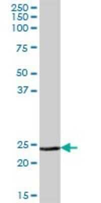 Western Blot: Methionine Sulfoxide Reductase A Antibody [H00004482-B01P] - Analysis of MSRA expression in human liver.