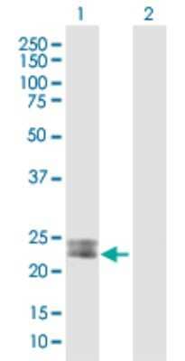 Western Blot: Methionine Sulfoxide Reductase A Antibody [H00004482-B01P] - Analysis of MSRA expression in transfected 293T cell line by MSRA polyclonal antibody.  Lane 1: MSRA transfected lysate(25.85 KDa). Lane 2: Non-transfected lysate.