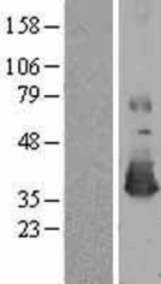 Western Blot Methionine Sulfoxide Reductase A Overexpression Lysate