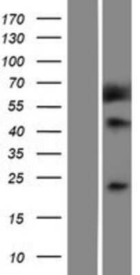 Western Blot Methionine Sulfoxide Reductase A Overexpression Lysate