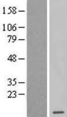 Western Blot: Methionine Sulfoxide Reductase B Overexpression Lysate (Adult Normal) [NBL1-15819] Left-Empty vector transfected control cell lysate (HEK293 cell lysate); Right -Over-expression Lysate for Methionine Sulfoxide Reductase B.