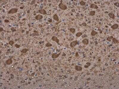 Immunohistochemistry-Paraffin: Methionyl tRNA synthetase Antibody [NBP3-13217] - Methionyl tRNA synthetase antibody detects Methionyl tRNA synthetase protein at cytoplasm in mouse brain by immunohistochemical analysis. Sample: Paraffin-embedded mouse brain. Methionyl tRNA synthetase antibody (NBP3-13217) diluted at 1:500. Antigen Retrieval: Citrate buffer, pH 6.0, 15 min