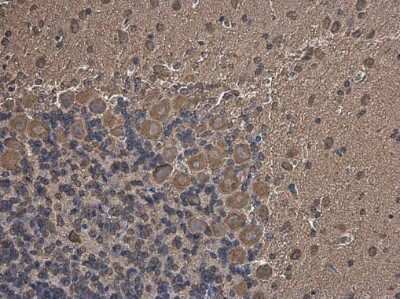 Immunohistochemistry-Paraffin: Methionyl tRNA synthetase Antibody [NBP3-13217] - Methionyl tRNA synthetase antibody detects Methionyl tRNA synthetase protein at cytoplasm in rat brain by immunohistochemical analysis. Sample: Paraffin-embedded rat brain. Methionyl tRNA synthetase antibody (NBP3-13217) diluted at 1:500. Antigen Retrieval: Citrate buffer, pH 6.0, 15 min