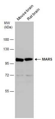 Western Blot: Methionyl tRNA synthetase Antibody [NBP3-13217] - Various tissue extracts (50 ug) were separated by 7.5% SDS-PAGE, and the membrane was blotted with Methionyl tRNA synthetase antibody (NBP3-13217) diluted at 1:1000.