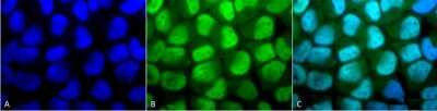 Immunocytochemistry/Immunofluorescence: Methyl-Lysine Antibody [NB600-824] - Tissue: HeLa Cells. Species: Human. Fixation: 2% Formaldehyde for 20 min at RT. Primary Antibody: Rabbit Anti-Methylated Lysine Polyclonal Antibody at 1:50 for 12 hours at 4 degrees C. Secondary Antibody: FITC Goat Anti-Rabbit (green) at 1:200 for 2 hours at RT. Counterstain: DAPI (blue) nuclear stain at 1:40000 for 2 hours at RT. Localization: Nucleus. Cytoplasm. Magnification: 100x. (A) DAPI (blue) nuclear stain. (B) Anti-Methylated Lysine Antibody. (C) Composite.
