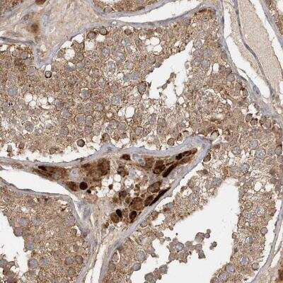 Immunohistochemistry: Methylmalonyl Coenzyme A mutase Antibody [NBP2-34024] - Staining of human testis shows moderate cytoplasmic positivity in cells in seminiferus ducts, Leydig cells were strongly stained.