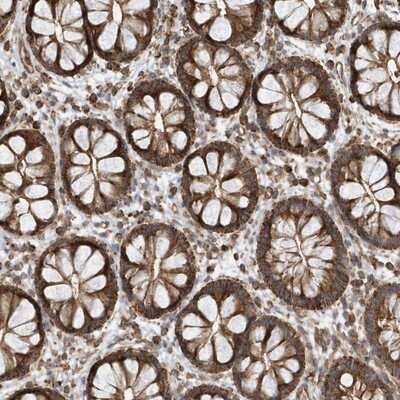 Immunohistochemistry-Paraffin: Methylmalonyl Coenzyme A mutase Antibody [NBP1-87423] - Staining of human rectum shows strong cytoplasmic positivity in glandular cells.