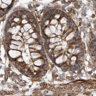 Immunohistochemistry-Paraffin: Methylmalonyl Coenzyme A mutase Antibody [NBP1-87423] - Staining of human colon.