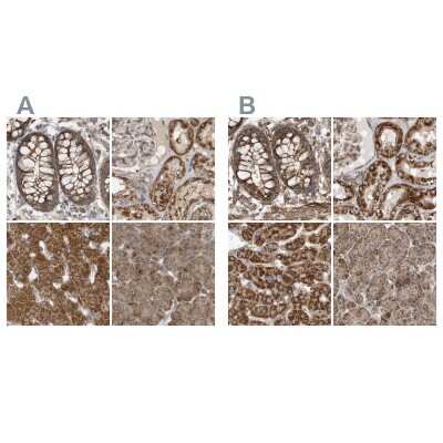 <b>Independent Antibodies Validation. </b>Immunohistochemistry-Paraffin: Methylmalonyl Coenzyme A mutase Antibody [NBP2-34024] - Staining of human colon, kidney, liver and pancreas using Anti-MUT antibody NBP2-34024 (A) shows similar protein distribution across tissues to independent antibody NBP1-87423 (B).