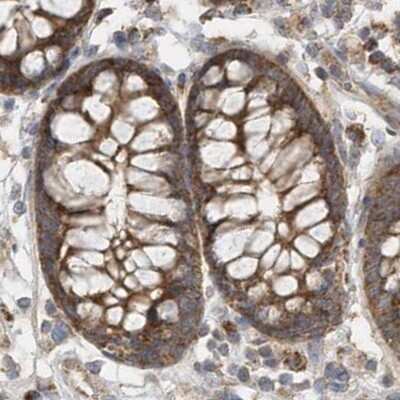 Immunohistochemistry-Paraffin: Methylmalonyl Coenzyme A mutase Antibody [NBP2-34024] - Staining of human colon.