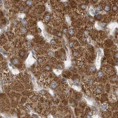Immunohistochemistry-Paraffin Methylmalonyl Coenzyme A mutase Antibody - BSA Free