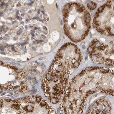 Immunohistochemistry-Paraffin: Methylmalonyl Coenzyme A mutase Antibody [NBP2-34024] - Staining of human kidney.