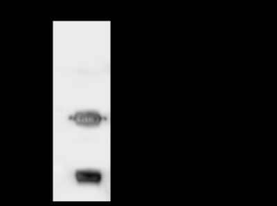 Immunoprecipitation: Methylmalonyl Coenzyme A mutase Antibody [NBP2-97332] - Methylmalonyl Coenzyme A mutase was immunoprecipitated using: Lane A: 0.5 mg A431 Whole Cell Lysate. 4 ul anti-Methylmalonyl Coenzyme A mutase rabbit polyclonal antibody and 60 ug of Immunomagnetic beads. Protein A/G. Primary antibody: Anti-Methylmalonyl Coenzyme A mutase rabbit polyclonal antibody, at 1:100 dilution. Secondary antibody: Goat Anti-Rabbit IgG (H+L)/HRP at 1/10000 dilution. Developed using the ECL technique. Performed under reducing conditions. Predicted band size: 83 kDa. Observed band size: 85 kDa