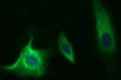 Immunocytochemistry/Immunofluorescence: Methylmalonyl Coenzyme A mutase Antibody (OTI2C8) - Azide and BSA Free [NBP2-72652] - Analysis of HeLa cells.