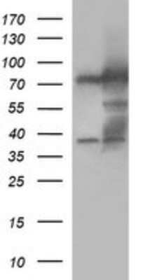 Western Blot: Methylmalonyl Coenzyme A mutase Antibody (OTI2C8) - Azide and BSA Free [NBP2-72652] - Analysis of HEK293T cells were transfected with the pCMV6-ENTRY control (Left lane) or pCMV6-ENTRY Methylmalonyl Coenzyme A.