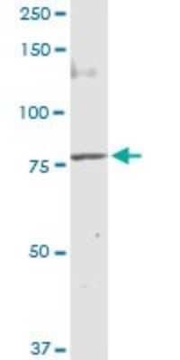 Western Blot: Methylmalonyl Coenzyme A mutase Antibody [H00004594-D01P] - Analysis of MUT expression in A-431.