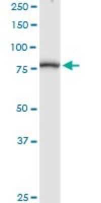 Western Blot: Methylmalonyl Coenzyme A mutase Antibody [H00004594-D01P] - Analysis of MUT expression in human liver.