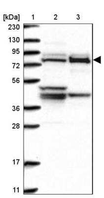 Western Blot: Methylmalonyl Coenzyme A mutase Antibody [NBP1-87423] - Lane 1: Marker  [kDa] 230, 130, 95, 72, 56, 36, 28, 17, 11.  Lane 2: Human cell line RT-4.  Lane 3: Human cell line U-251MG sp