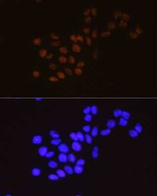 Immunocytochemistry/Immunofluorescence: Methyltransferase like 3 Antibody (1R6X6) [NBP3-15652] - Immunofluorescence analysis of HeLa cells using Methyltransferase like 3 Rabbit mAb (NBP3-15652) at dilution of 1:100 (40x lens). Blue: DAPI for nuclear staining.