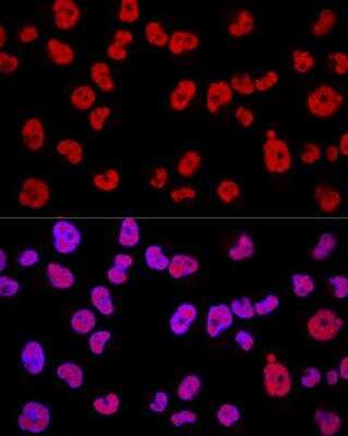 Immunocytochemistry/Immunofluorescence: Methyltransferase like 3 Antibody [NBP3-03290] - Analysis of Hela cells using METTL3 Polyclonal Antibody at dilution of 1:200. Blue: DAPI for nuclear staining.