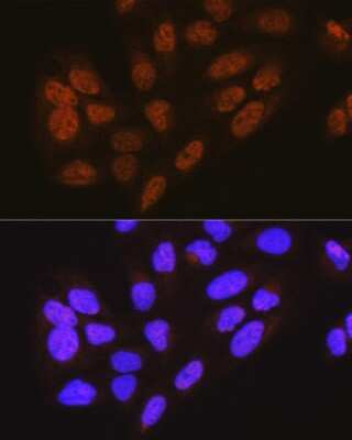 Immunocytochemistry/Immunofluorescence: Methyltransferase like 3 Antibody [NBP3-03290] - Immunofluorescence analysis of U-2 OS cells using Methyltransferase like 3 Rabbit pAb (NBP3-03290) at dilution of 1:100 (40x lens). Blue: DAPI for nuclear staining.