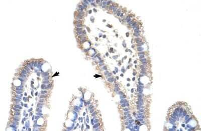 Immunohistochemistry: Methyltransferase like 3 Antibody [NBP2-82284] - Human Intestine