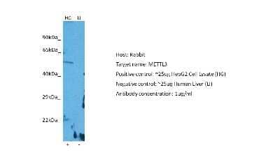 Western Blot: Methyltransferase like 3 Antibody [NBP2-82284] - Host: Rabbit. Target: METTL3. Positive control (+): HepG2 Cell Lysate (HG). Negative control (-): Human Liver Tumor (T-LI). Antibody concentration: 1ug/ml