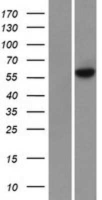 Western Blot Methyltransferase like 3 Overexpression Lysate