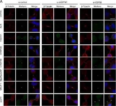 Immunocytochemistry/Immunofluorescence: MgcRacGAP/RACGAP1 Antibody (1G6) [H00029127-M01] - iASPP-dependent localization of midbody markers.a Localization of midbody markers in control, iASPP-depleted, or CEP55-depleted HeLa cells. HeLa cells were transfected with indicated siRNAs. After 48?h, cells were immunostained for midbody markers (green), Beta-tubulin (red), and DNA (blue). b Quantification of proportions of cells from a displaying defects in localization of markers at the midbody Image collected and cropped by CiteAb from the following publication (//www.nature.com/articles/s41419-018-0561-6) licensed under a CC-BY license.