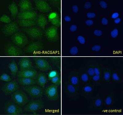 Immunocytochemistry/Immunofluorescence: MgcRacGAP/RACGAP1 Antibody [NB100-884] - MCF7 cells, permeabilized with 0.15% Triton. Primary incubation 1hr (10ug/ml) followed by Alexa Fluor 488 secondary antibody (4ug/ml), showing nuclear staining. The nuclear stain is DAPI (blue). Negative control: Unimmunized goat IgG (10ug/ml) followed by Alexa Fluor 488 secondary antibody (4ug/ml).