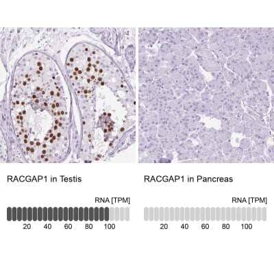 Immunohistochemistry-Paraffin: MgcRacGAP/RACGAP1 Antibody [NBP2-47374] - Analysis in human testis and pancreas tissues using NBP2-47374 antibody. Corresponding RACGAP1 RNA-seq data are presented for the same tissues.