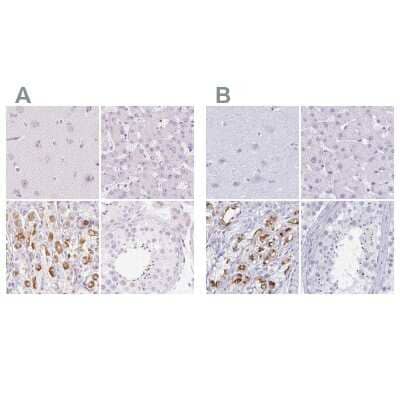 <b>Independent Antibodies Validation. </b>Immunohistochemistry-Paraffin: MiRP1 Antibody [NBP2-38146] - Staining of human cerebral cortex, liver, stomach and testis using Anti-KCNE2 antibody NBP2-38146 (A) shows similar protein distribution across tissues to independent antibody NBP2-38653 (B).