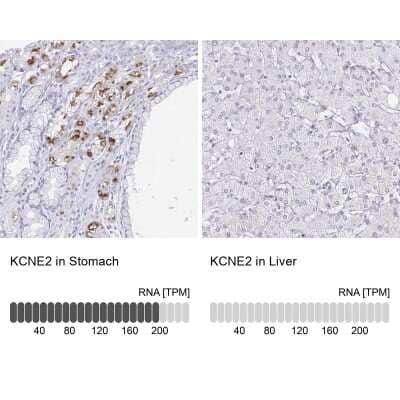 <b>Orthogonal Strategies Validation. </b>Immunohistochemistry-Paraffin: MiRP1 Antibody [NBP2-38653] - Staining in human stomach and liver tissues using anti-KCNE2 antibody. Corresponding KCNE2 RNA-seq data are presented for the same tissues.